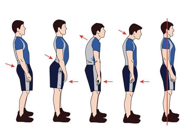 Posture Correction